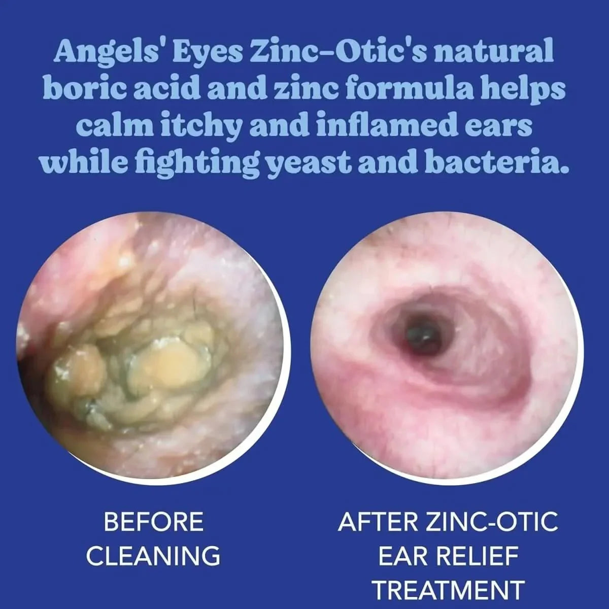 Angels' Eyes Zinc - Otic Ear Relief Treatment for Dogs & Cats 1 Ounce - Talis Us